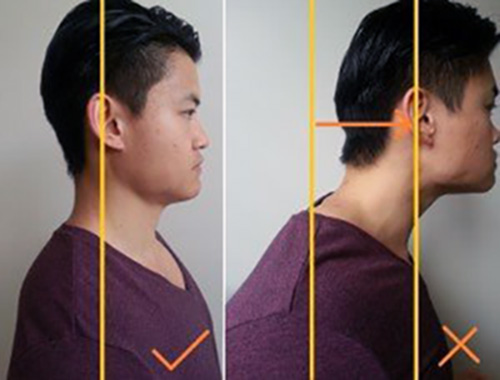 Как исправить наклон головы вперед (компьютерную шею)